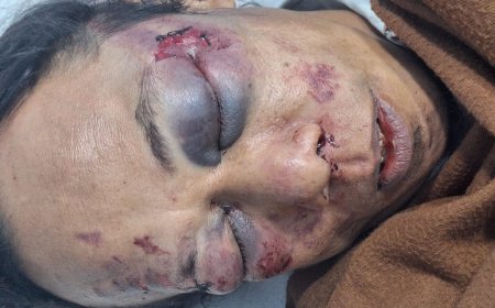 Kekerasan di Pulau Rempang: Delapan Warga Terluka dan Kendaraan Rusak