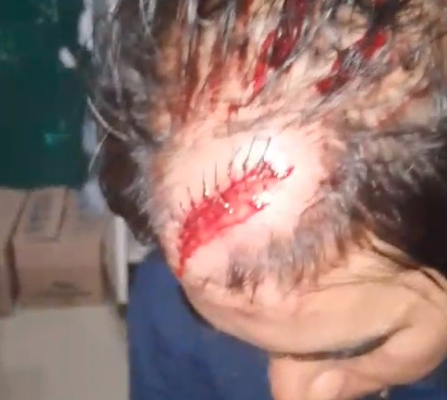 Breaking News : Masyarakat Rempang Kembali Diserang, Banyak Korban Luka, Kendaraan Dirusak