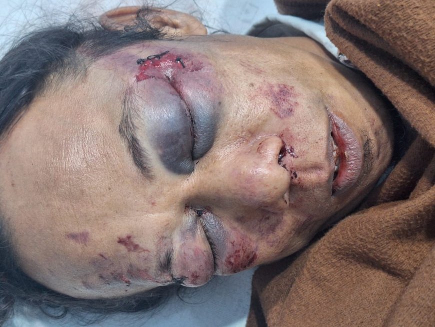 Kekerasan di Pulau Rempang: Delapan Warga Terluka dan Kendaraan Rusak